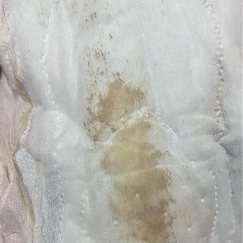 Bun tolong infonya dong ini tuh flek bukan yaa?