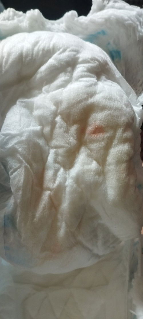Hi. Ask ko lang po kung blood po ba yung color orange stain sa diaper ni baby? 6 months old po siya.