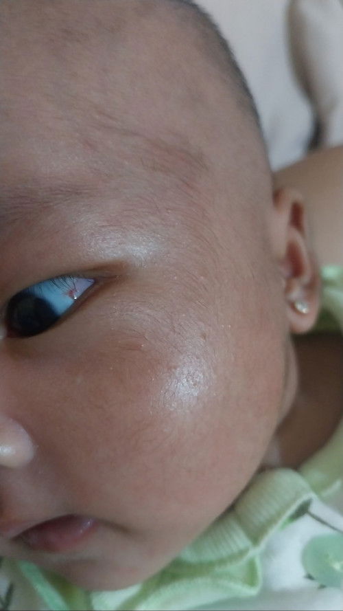 Sudut mata bayi merah