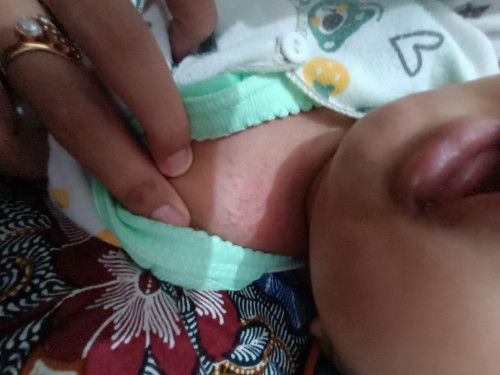 Biang keringat
