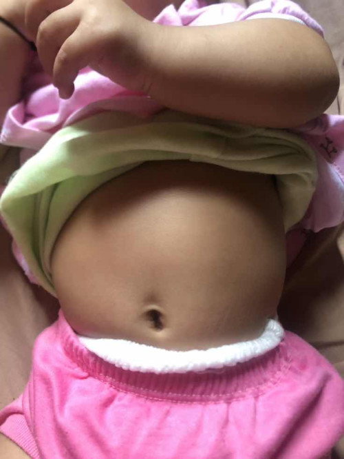 Anak belum bab seminggu