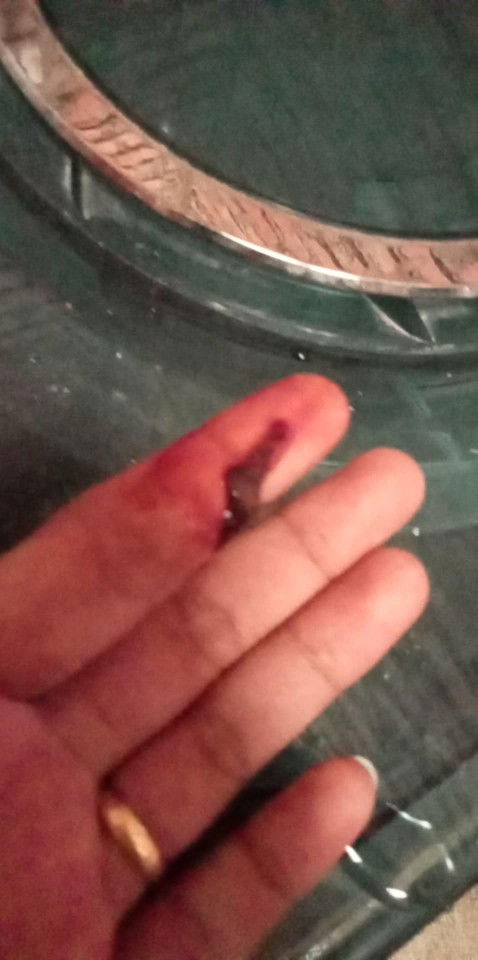 Keluar gumpalan darah