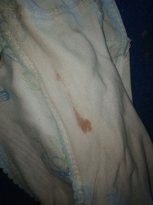 Maaf ya bunda agak sedikit jorok pertanyaan saya.....kalo flek seperti ini apa tanda kehamilan....??