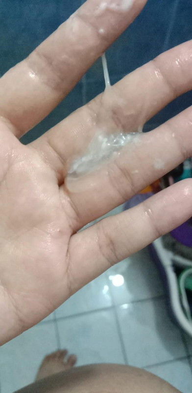 ขออภัยคนที่กำลังทานข้าวอยุ่ด้วยนะคะ มูกแบบนี้คือมูกใสใกล้คลอดใช่มั้ยคะอายุครรภ์37week