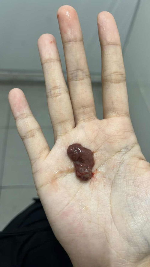 แบบนี้คืออะไรหรอคะ