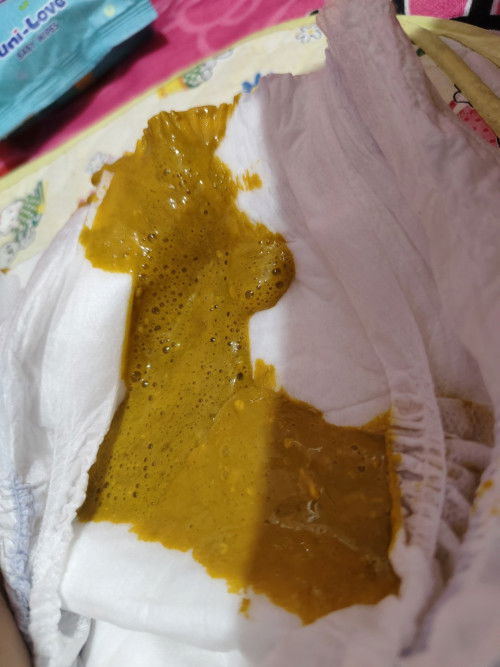 Color poop