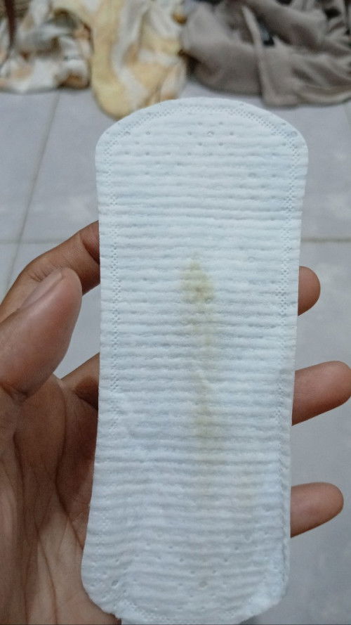 Keputihan atau flek