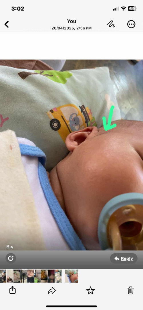 Normal ke bengkak mcm ini