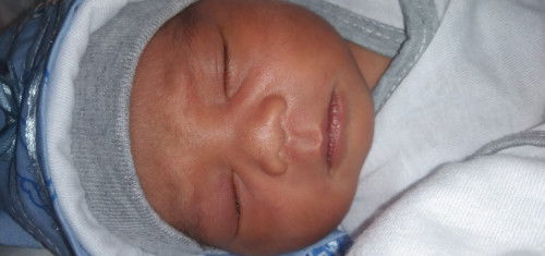nagmumuta po si baby na halos color nana na po yung lumalabas sa right eye niya, magagamot po ba ito