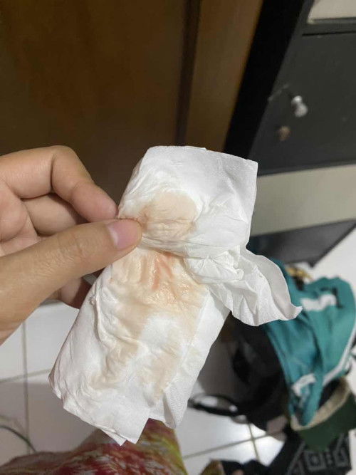 Hamil 22 minggu keluar bercak pink