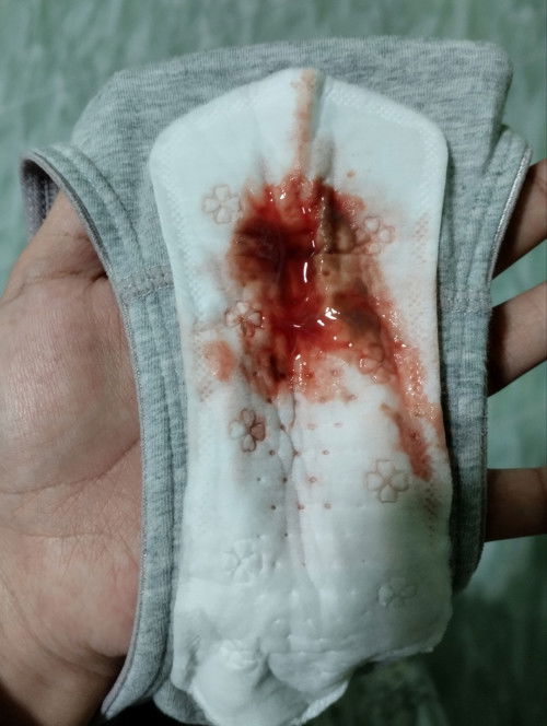 Blood show ke?