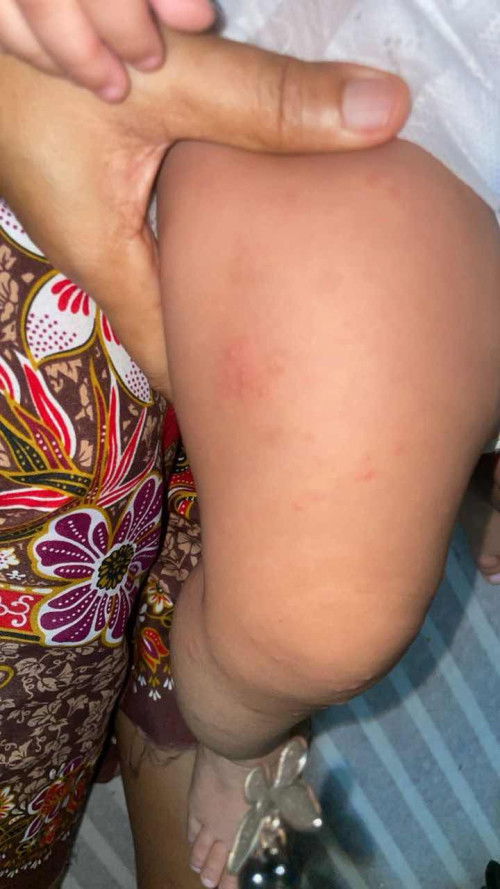 alergik atau tidak?