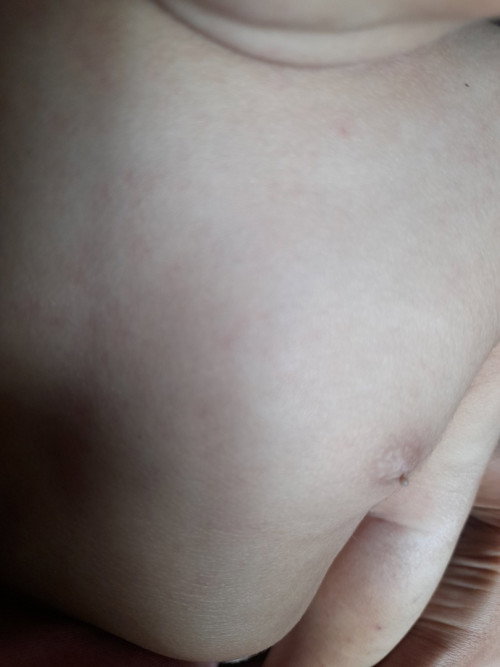 Ada sesuatu pada pentil anak prmpuan