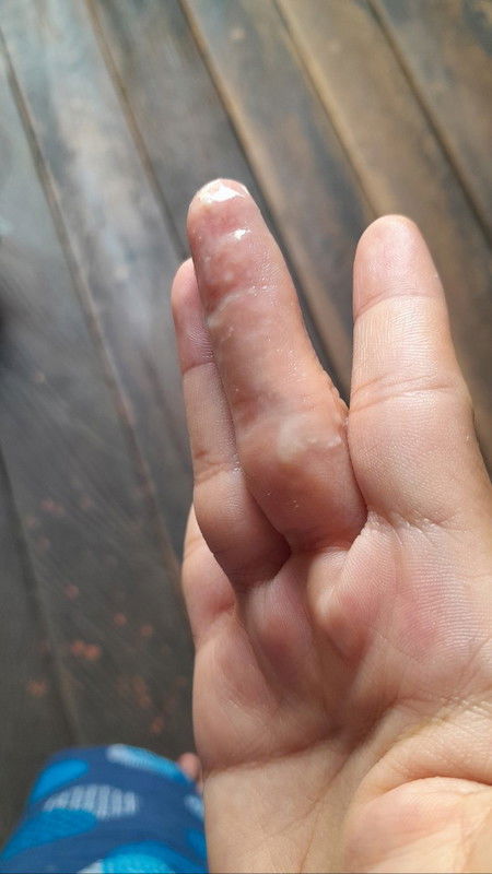 Hamil 24 week keluar keputihan putih berair