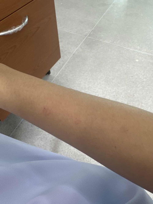 เชื้อราแมวคนท้อง