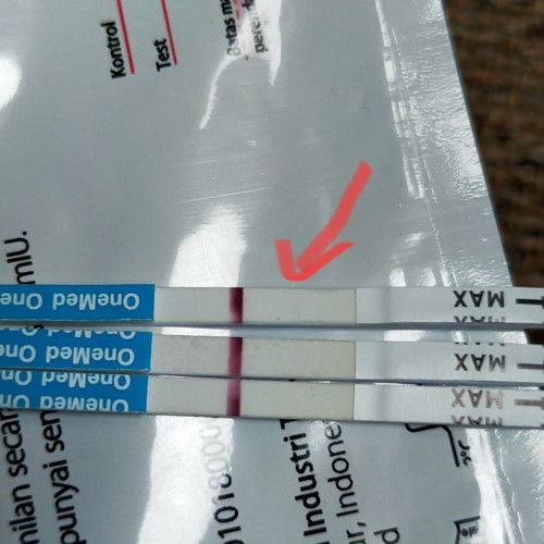 Halo bun mau tanya test pack kayak gini kira2 positif apa negatif ya Bun penantian 6 tahun