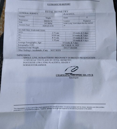 Ano pong gender ni baby?
Makikita po ba?