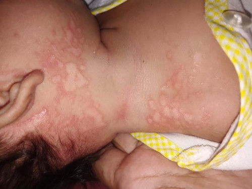 Biang keringat atau apa ya