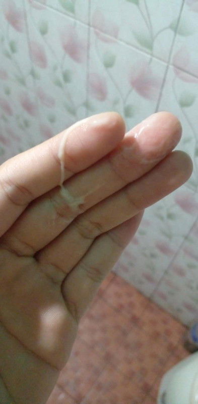 แบบนี้ปกติมั้ยค่ะ
