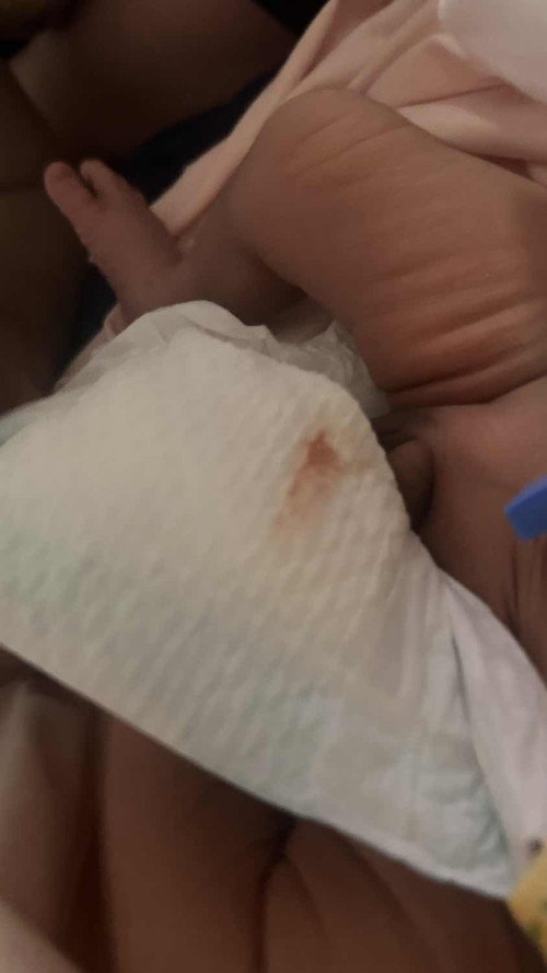 bayi 4 hari pipis berdarah