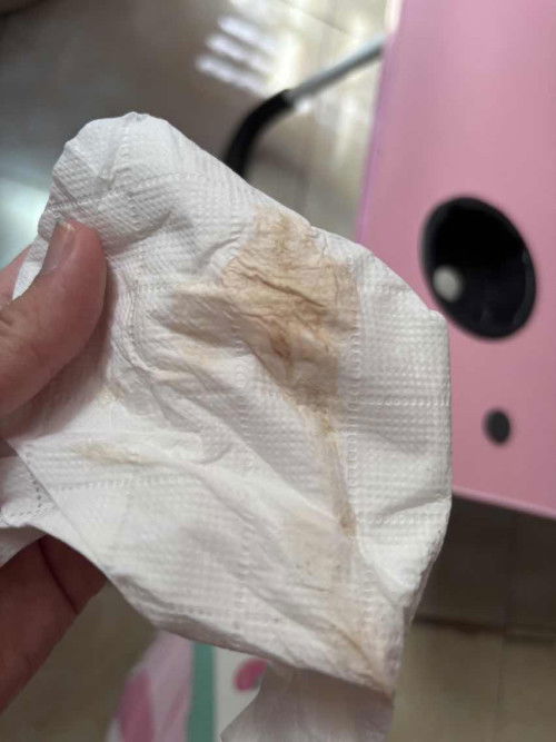 Brownish discharge