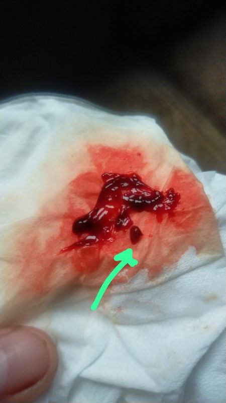 Bun mau tanya waktu itu saya Uda telat 2 mgg terus haid lagi tapi kok ada yg keluar gitu Bun ..
