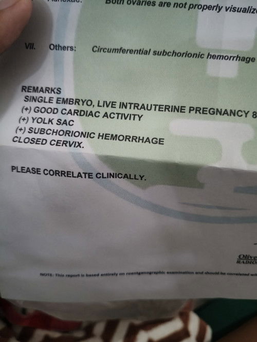 Subchorionic hemorrhage