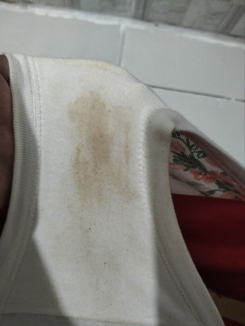 Brown discharge 35weeks preggy