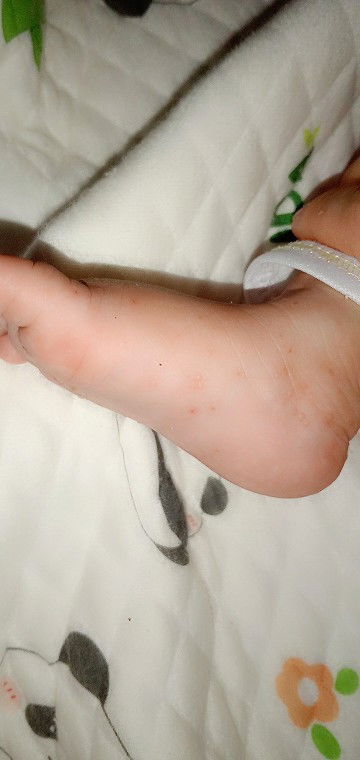 cho e chut y kiến với ak con e bị bj j vậy ak bs bảo là bị phong a không biết là phải bị phong không