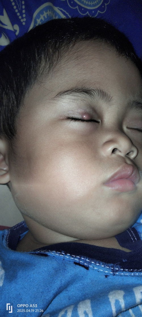 Seputar Mata Anak