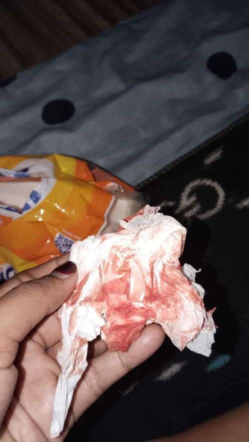 Udah kluar darah dan lendir