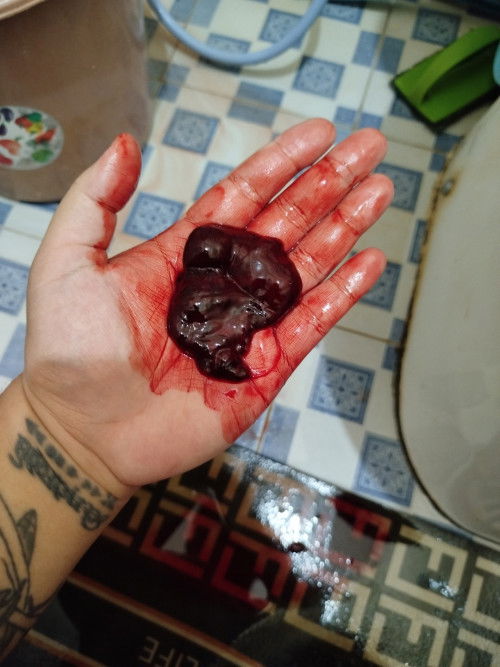 apakah ini bakal janin atau bukan yaa bun??? soalnya aku ga tespek.. mohon pencerahannya..