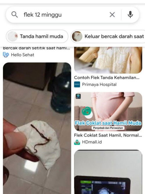 Keputihan bercampur flek coklat