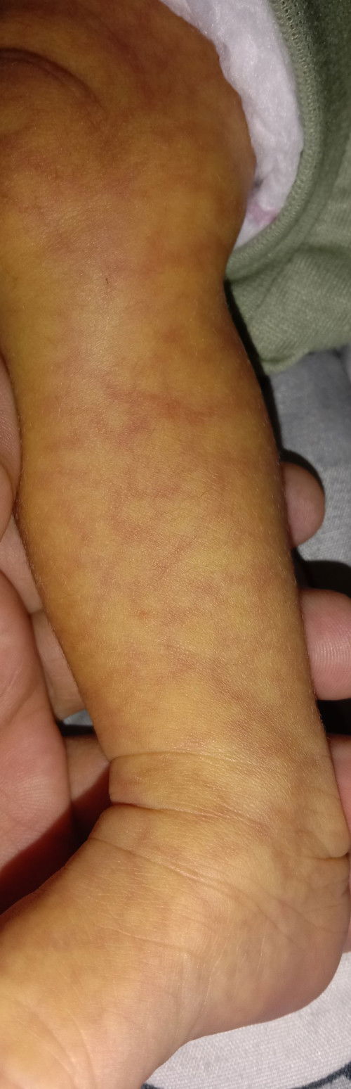 Ada solusinya gk bund