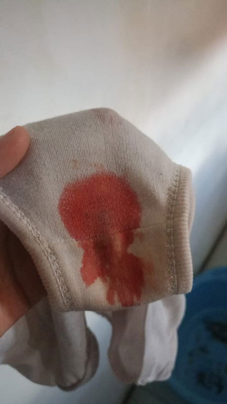 Hamil 5week7day
Mau tanya dong apakah ada yg sama