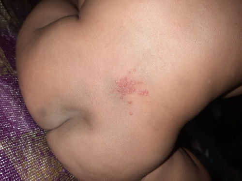 Binti merah apa ini ya bun?