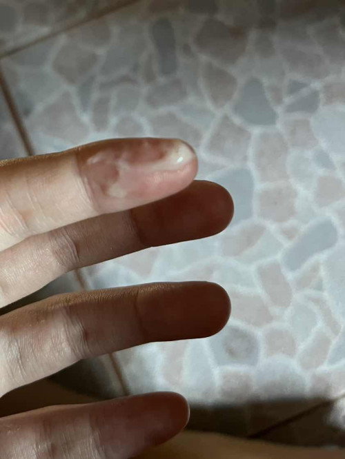 เเบบนี้ไกล้จะคลอดเเล้วใช่ไหมค่ะ🥹