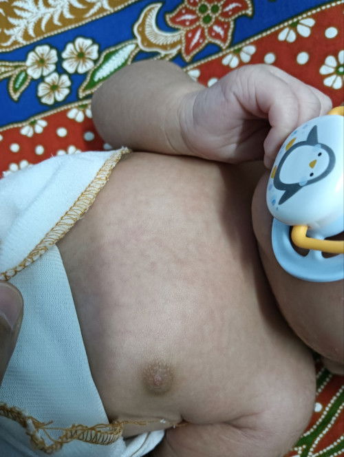 Ada tak mommies2 yg pengalaman badan baby nb naik mcm nih ...on off
Bahaya tak?