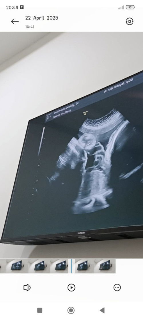 Menurut bunda2 jknya apa
Soalnya pas 4D nya gak keliatan