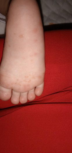 MN oi cho e hỏi là con e bị j vậy ak chút y kiến đi ak