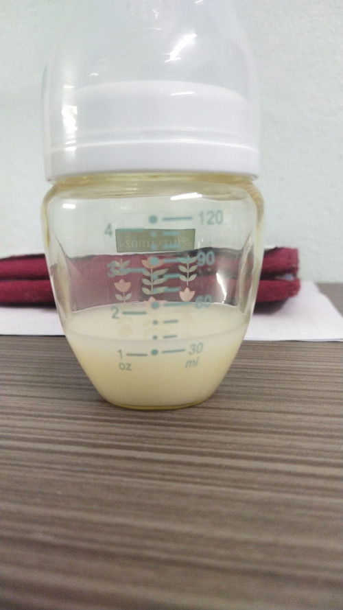 Anak saya lidah tongue tie, skrng baru hari ke 4 berpantang , anak saya x puas hisap , sampai puting
