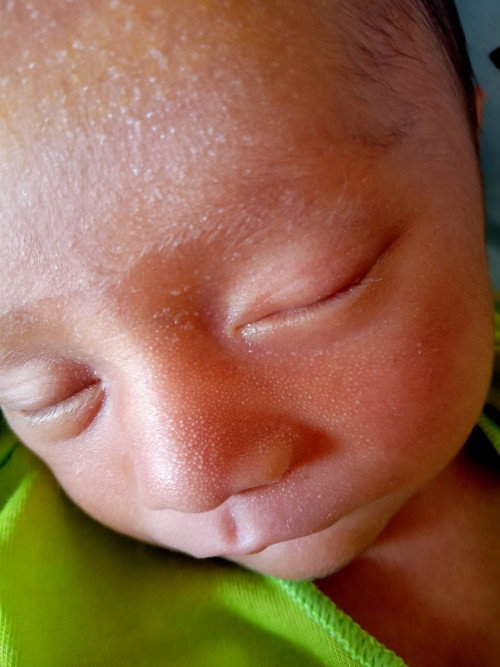 Bayi 10 hari