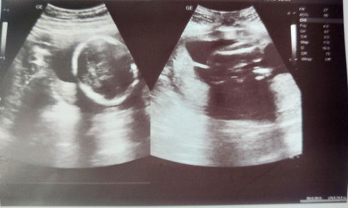 Gender not sure?