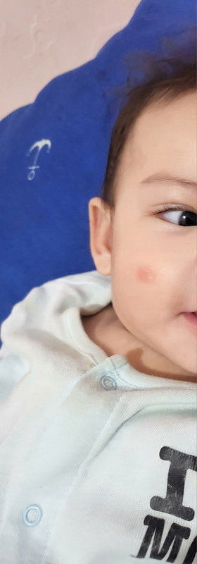 Ano po pwede igamot dito?! Red spot
