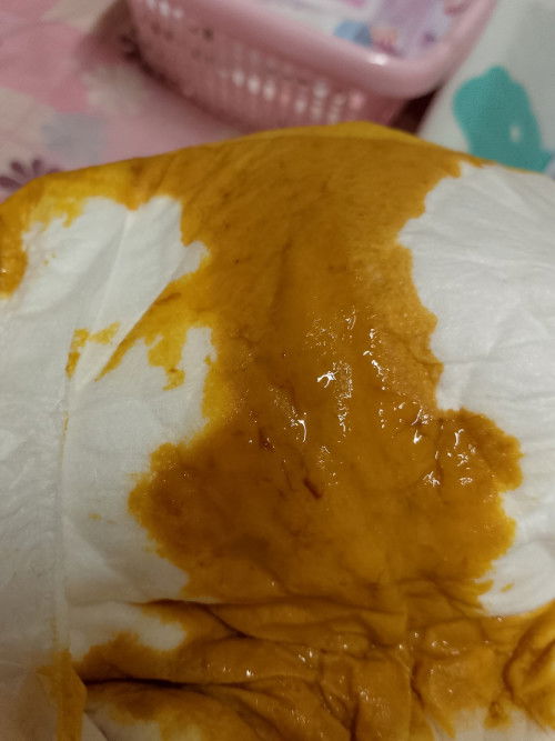 ถ่ายแบบนี้ต้องไปหาหมอมั้ยคะ