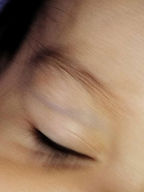 ugat sa eyelid ni baby
