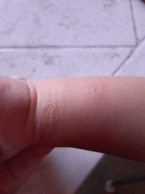 Butlig butlig pahelp po mga momshies ano po kaya pwede gawin 2years old po