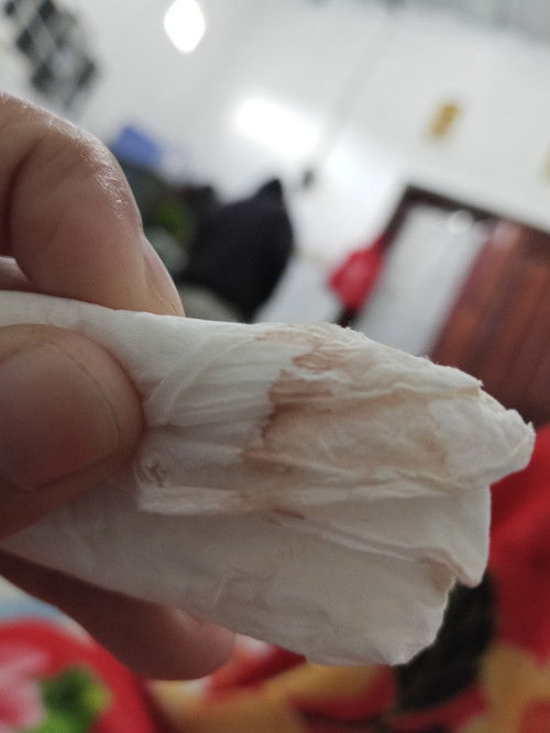 Keluar darah di Minggu ke 7