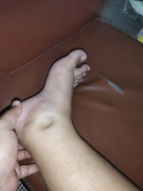 แบบนี้ควรไปหาหมอไหม