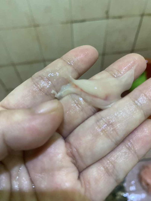 Keluar lendir campur darah di usia kandungan 38 minggu